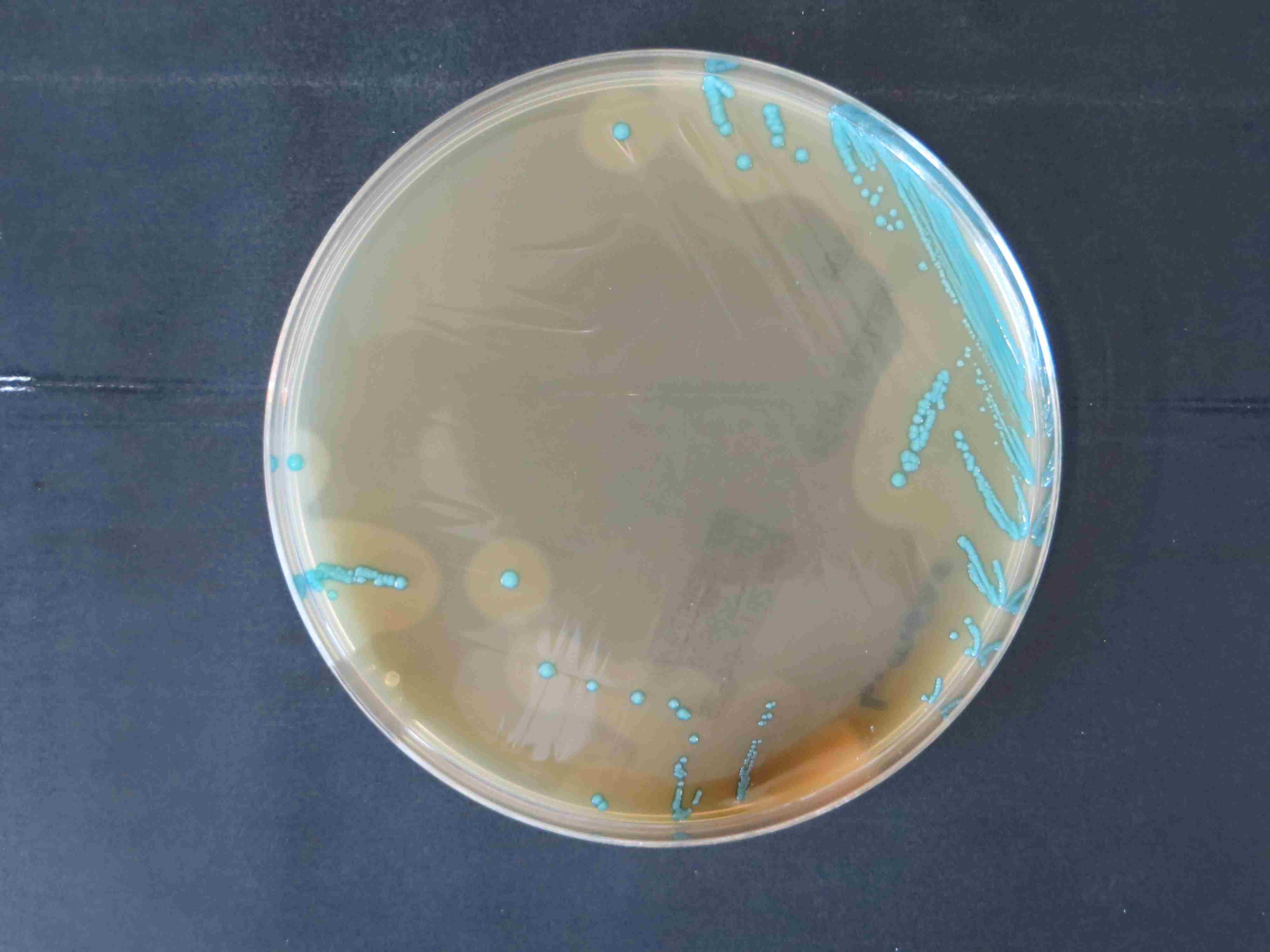  Das Foto zeigt eine Petrischale nach Ausstrich und Bebrütung des Untersuchungsmediums von oben. Man sieht den Bewuchs mit einzelnen türkisfarbenen Kolonien.