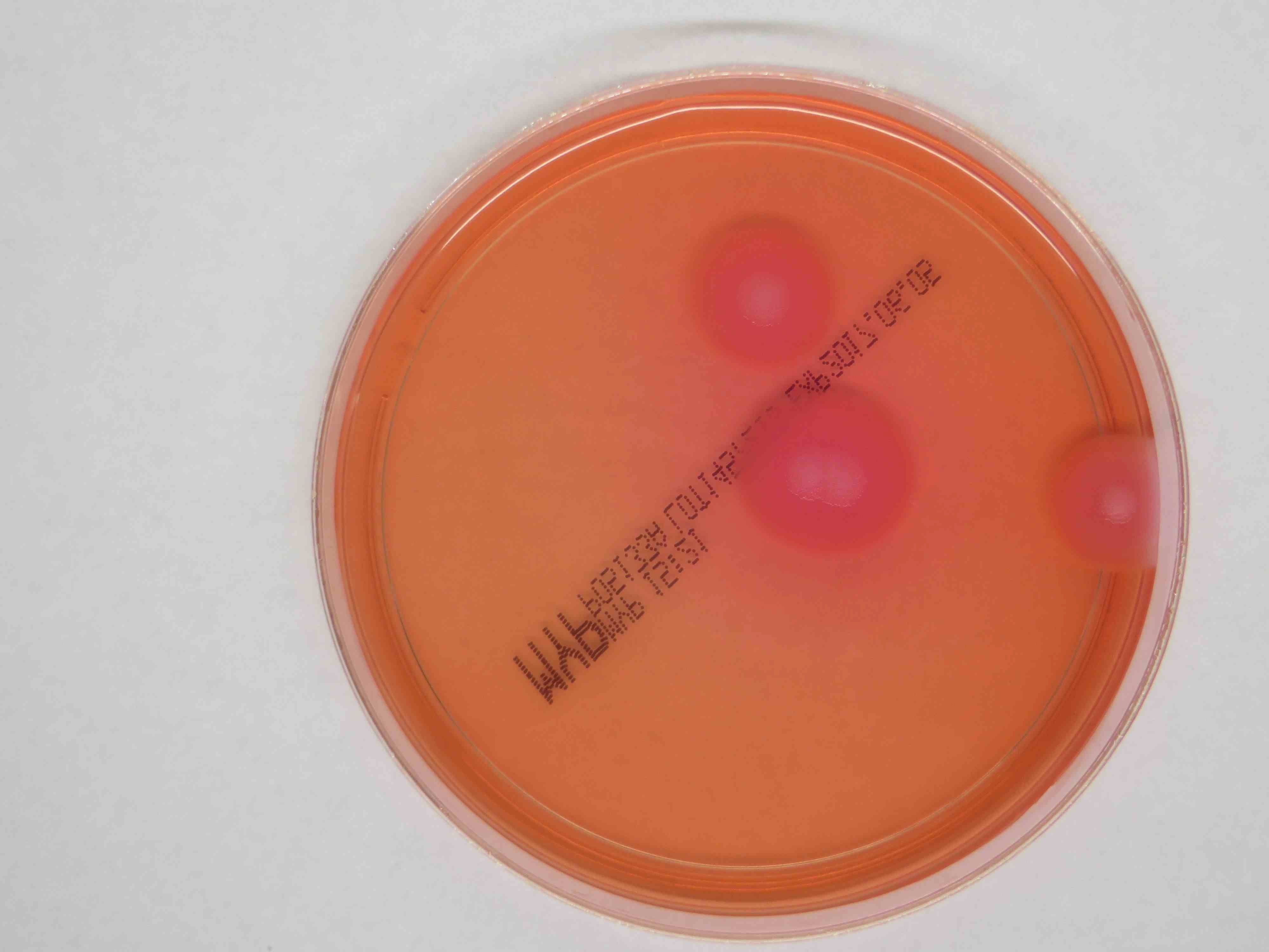 Das Bild zeigt eine Petrischale mit Bacillus cereus Kolonien