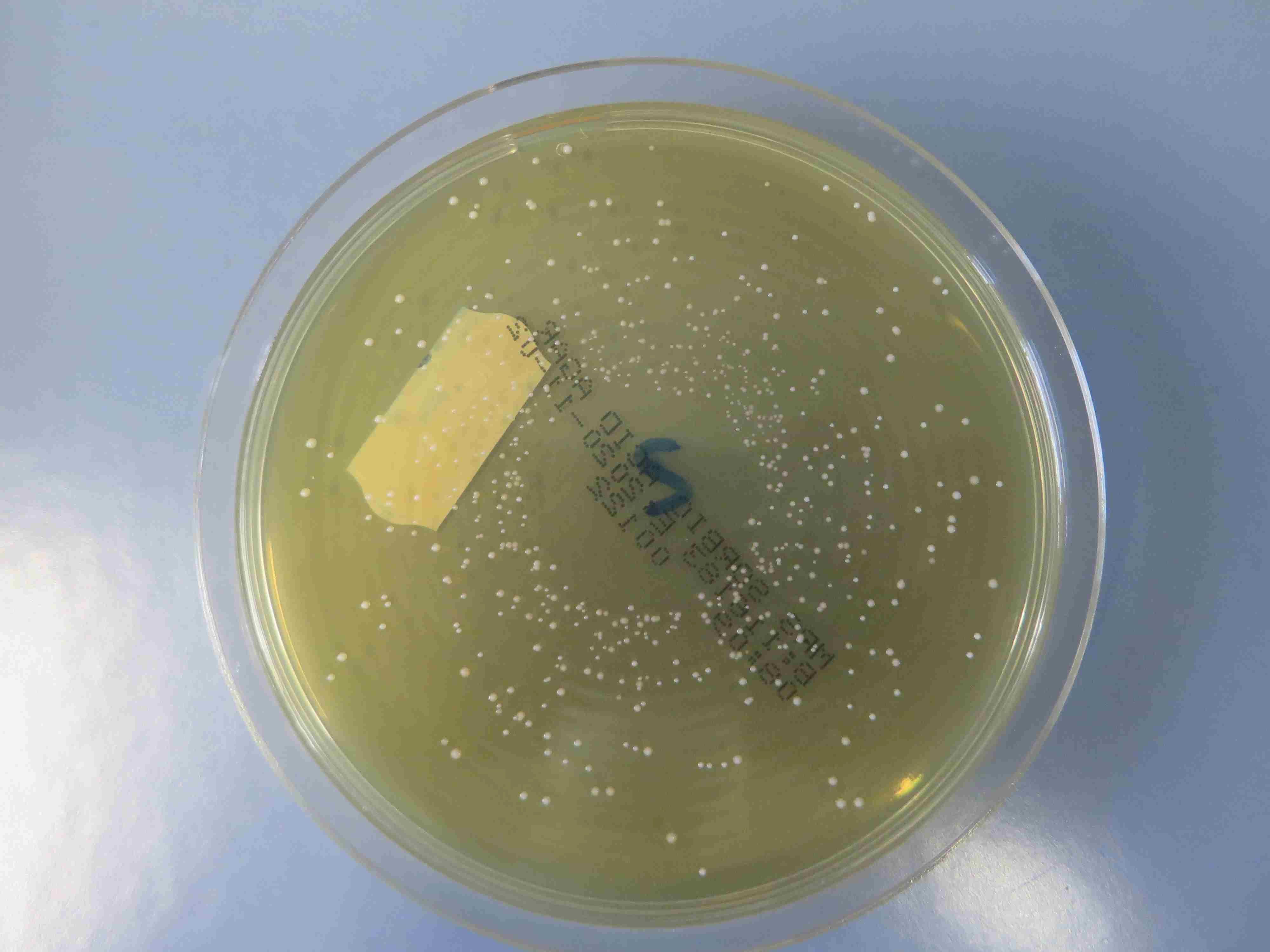 Das Bild zeigt eine Petrischale mit Milchsäurebildnerkolonien