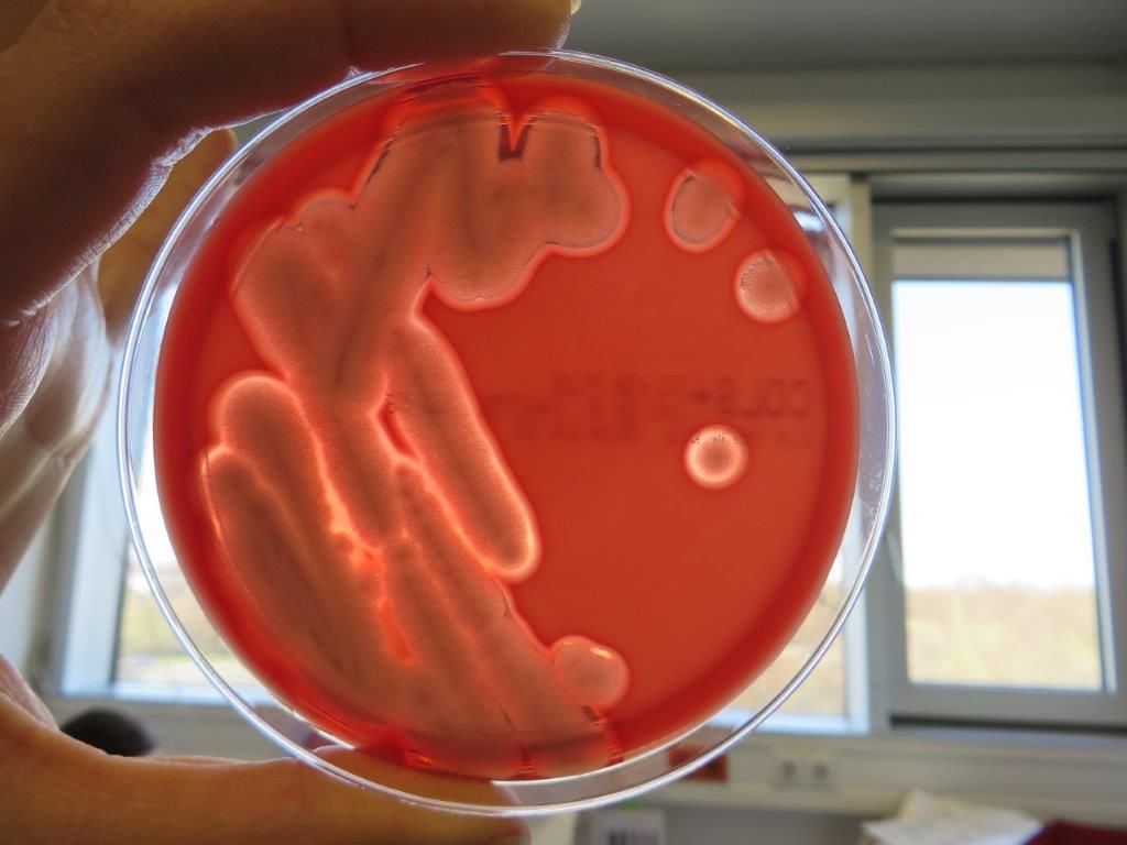 Große runde raue Bakterienkolonien auf einem roten Nährmedium; um die Kolonien herum helle Höfe