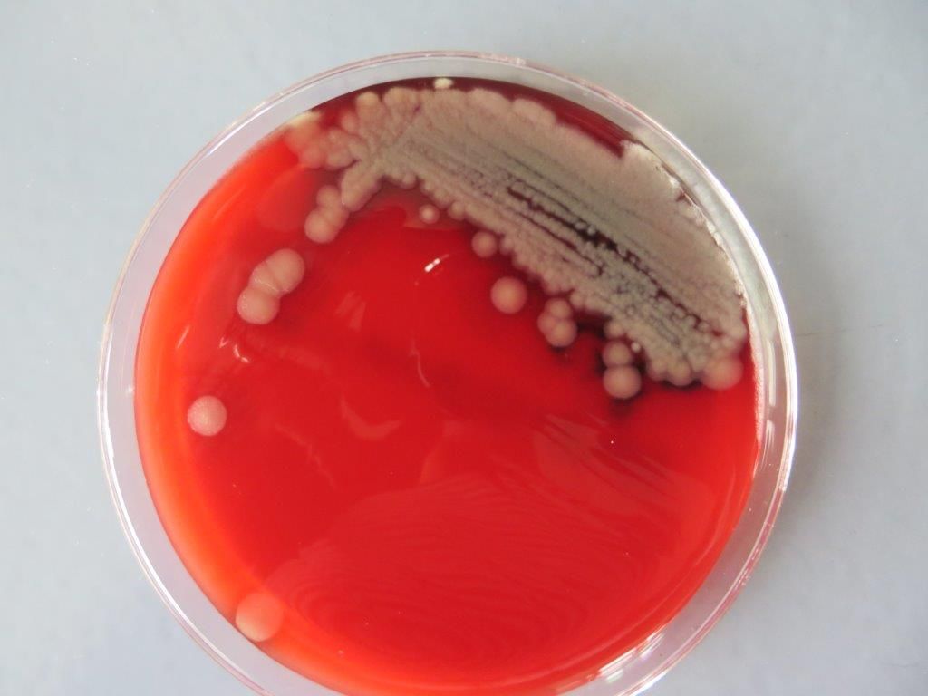rote Agarplatte, sichtbare Bakterienkolonien, umgeben von hellen Höfen