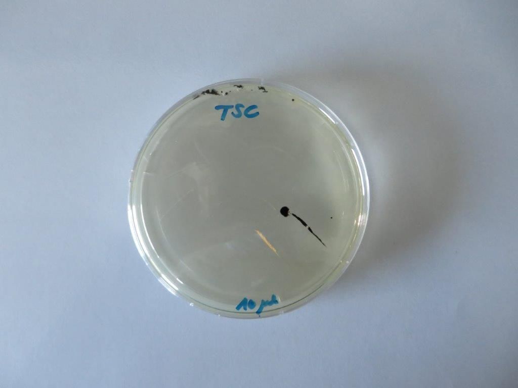 Auf dem Bild ist eine Agarplatte mit schwarzgefärbten Clostridien-Kolonien zu sehen.
