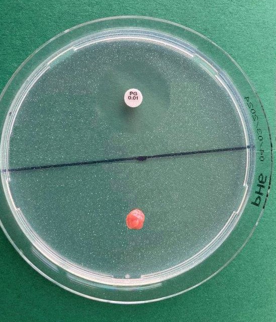 Auf dem Bild ist eine in zwei Segmente geteilte Hemmstoffplatte zu sehen. Um das Testplättchen auf der linken Seite ist deutlich ein Hemmhof zu erkennen, um ein ausgestanztes Nierenstück auf der rechten Seite ist kein Hemmhof vorhanden.