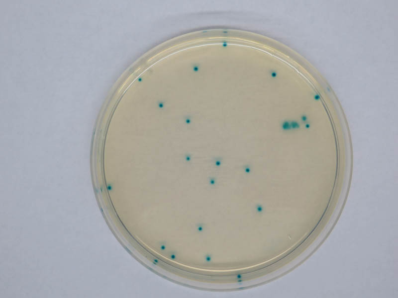 Petrischale mit runden, kleinen blauen Eschericha coli-Kolonien