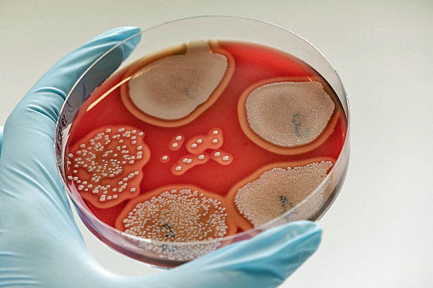 Abb. 15: Kolonien von Staphylococcus aureus mit typischer Hämolyse in Vedünnungstufen.